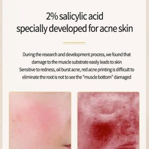 Acne Removing Salicylate Products